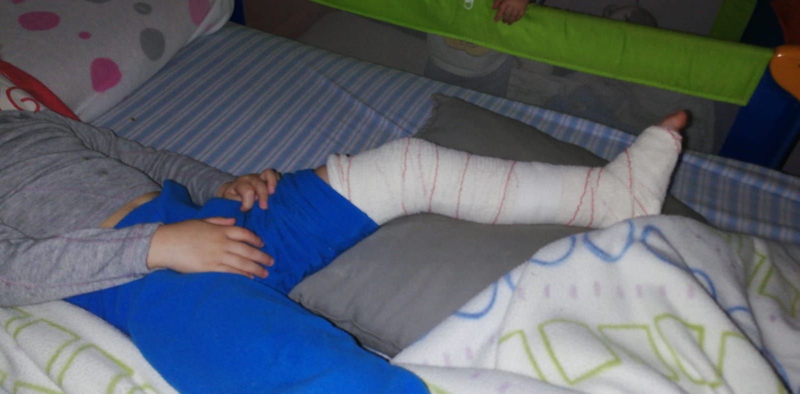 Imagen de la pierna escayolada del pequeño de 4 años. FOTO: LVDS. 