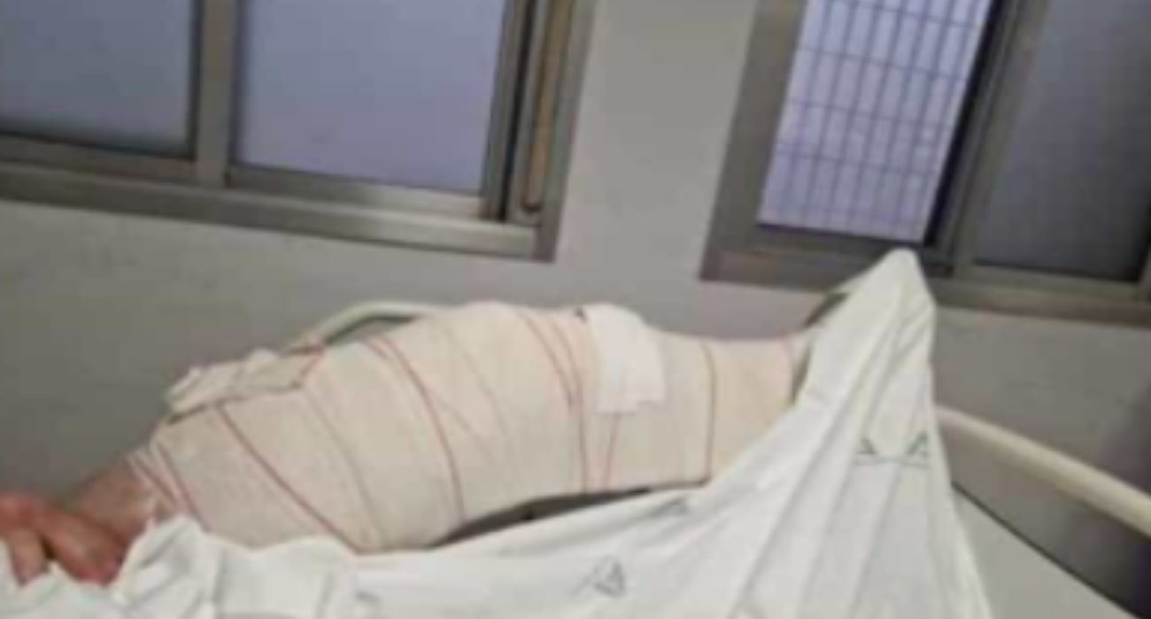 El joven, con la pierna escayolada, en el Hospital de Jerez.