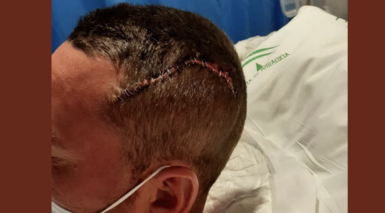 Herido grave tras sufrir una paliza a manos de unos jóvenes a las puertas de su casa en Algeciras.