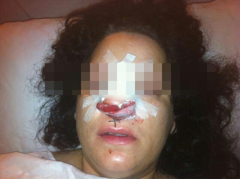 Imágenes de la mujer agredida por la policía de Córdoba. 