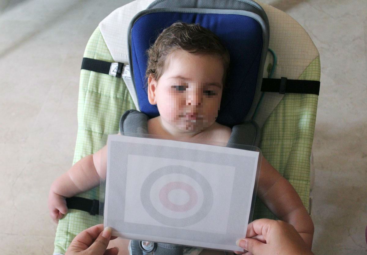 El pequeño Eric, el algecireño afectado por el trastorno CDKL5 que solo sufren 18 niños en España.