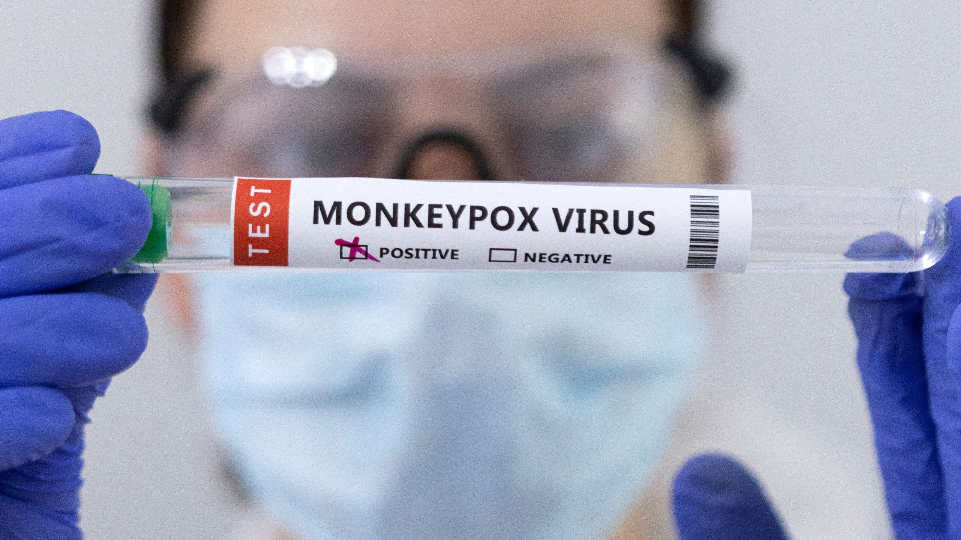 Una sanitaria con un test de la viruela del mono.