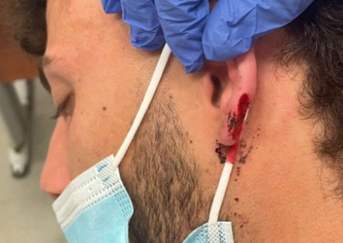 Agresión homófoba a un joven en la discoteca El Cortijo, en Vejer. INSTAGRAM Agresión homófoba a un joven en la discoteca El Cortijo, en Vejer. INSTAGRAM