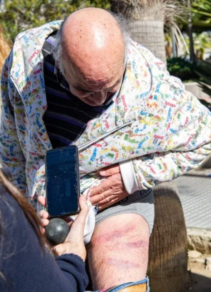 Vicente, tras ser agredido.