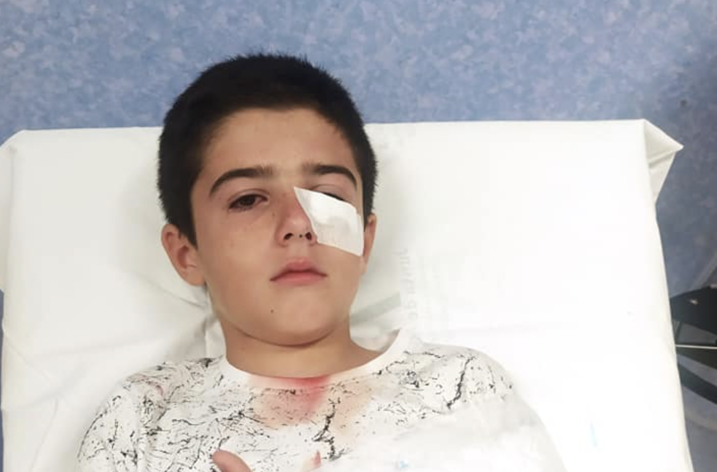 El jerezano casi pierde el ojo y su madre pide arreglar la plazoleta donde jugaba en La Granja.   FACEBOOK