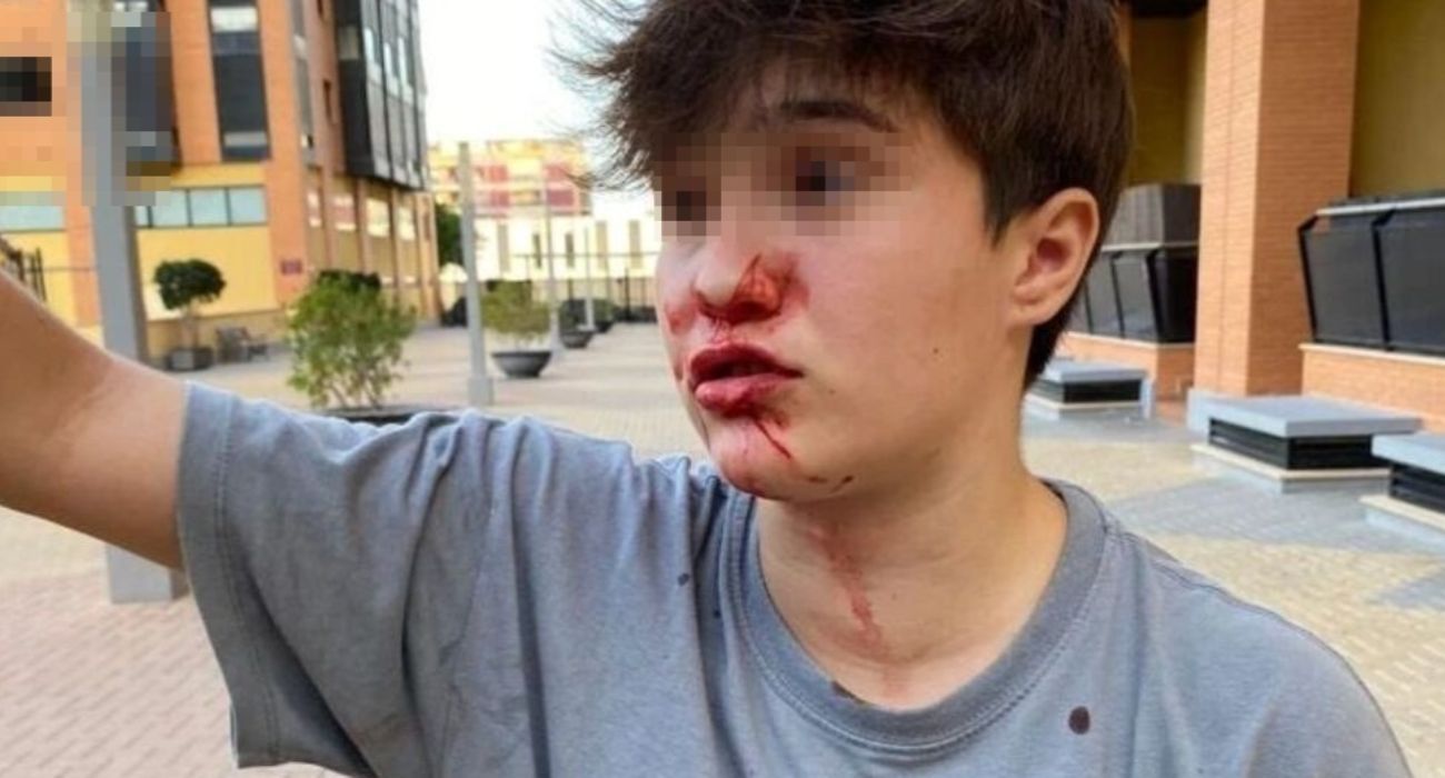 La agresión homófoba sufrida por una chica de 15 años.