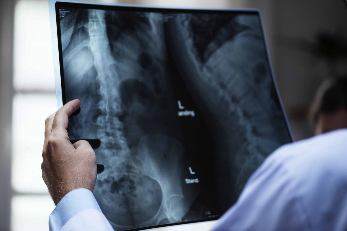 Un especialista de radiodiagnóstico, con una radiografía, en una imagen de CCOO.