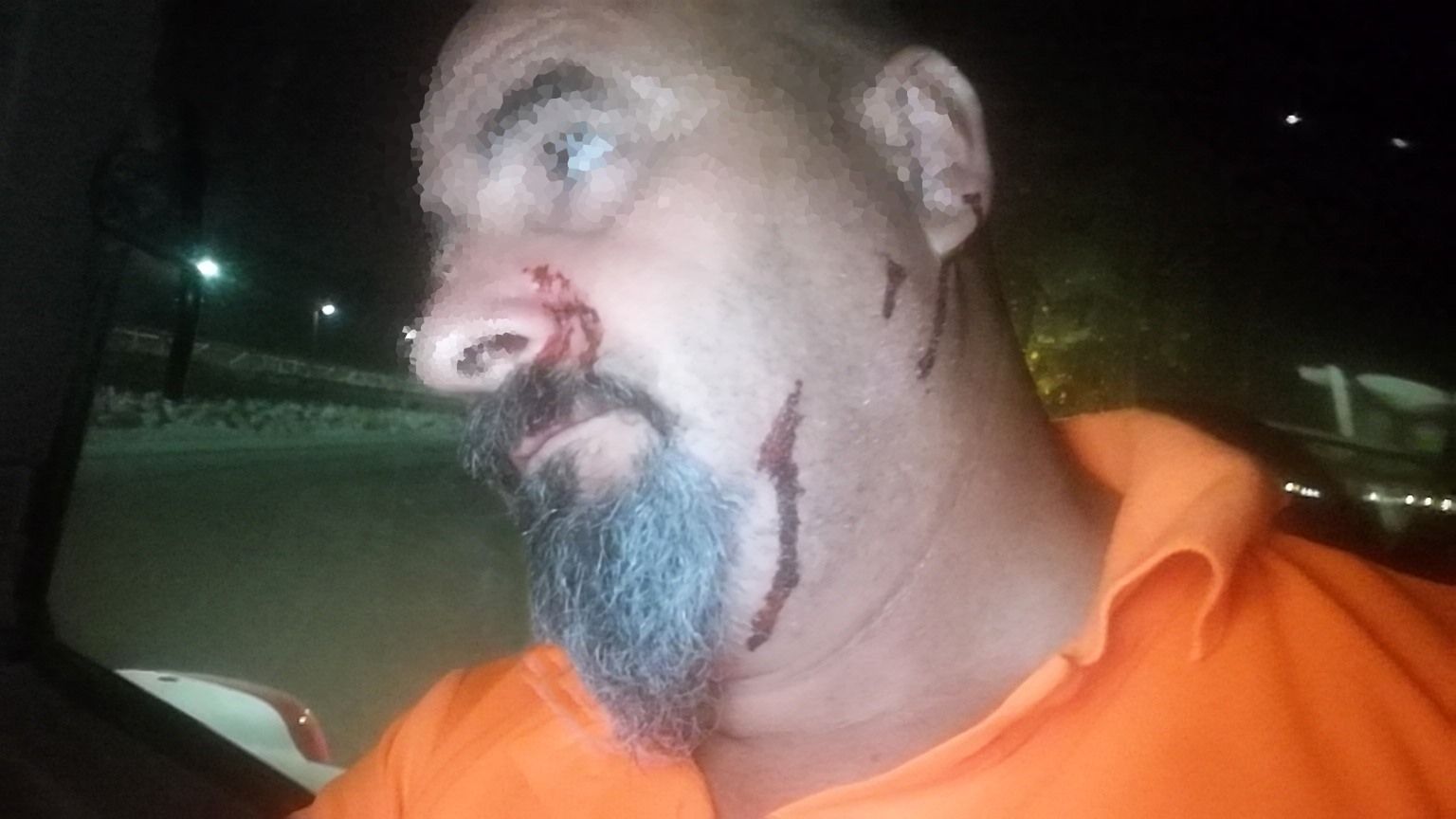 El trabajador portuense agredido mientras limpiaba la playa.