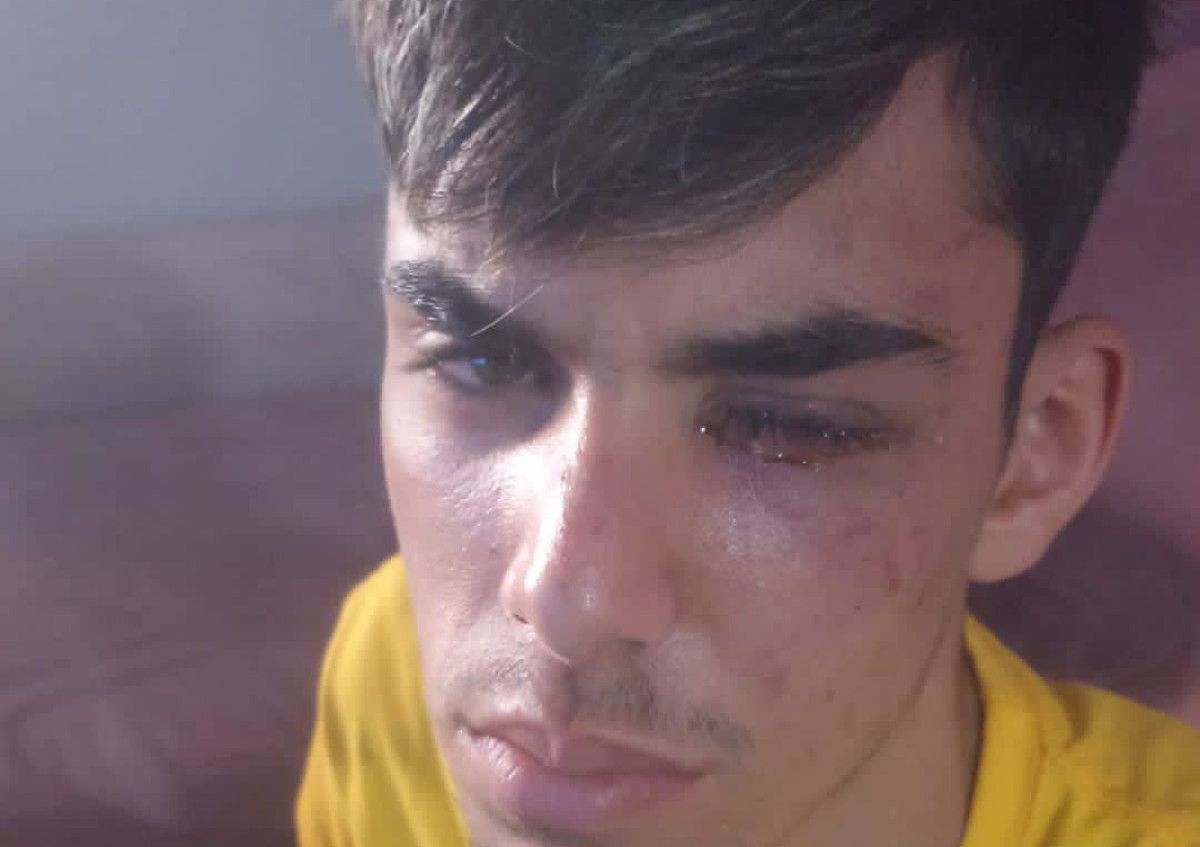 José Ascanio, víctima de una brutal agresión en plena calle en El Puerto.