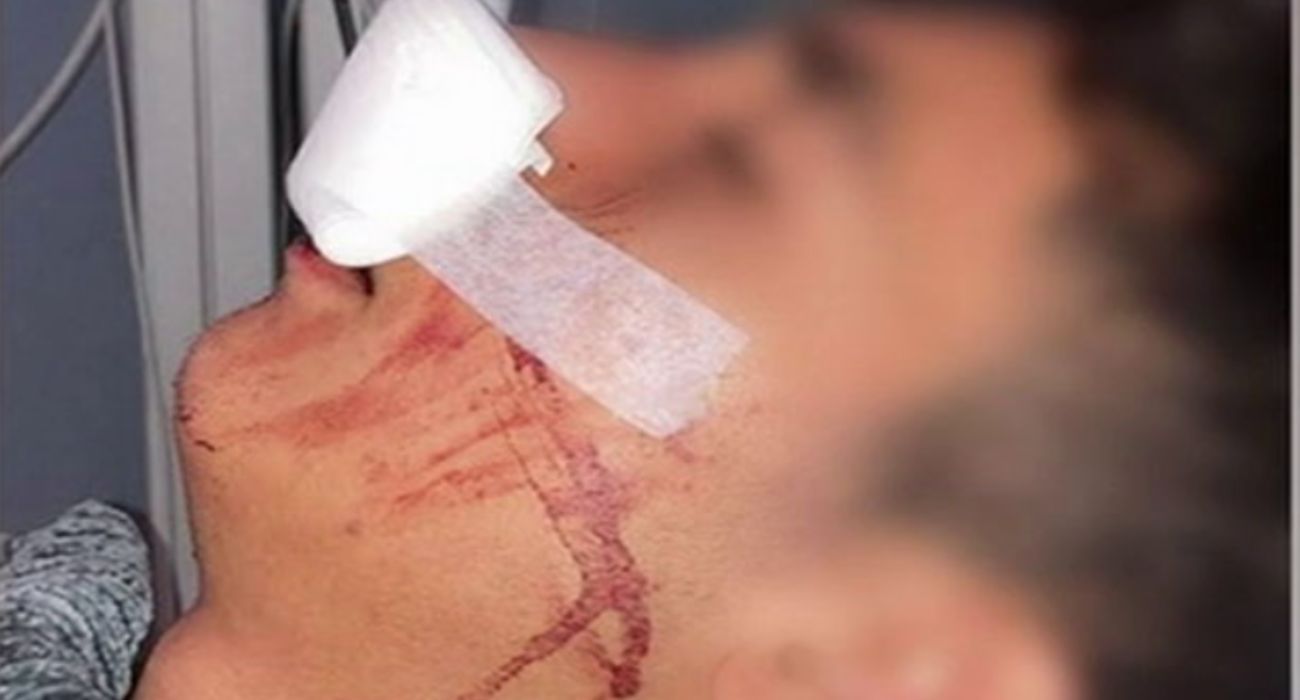 Una de las víctimas del Halloween de terror en Los Remedios.