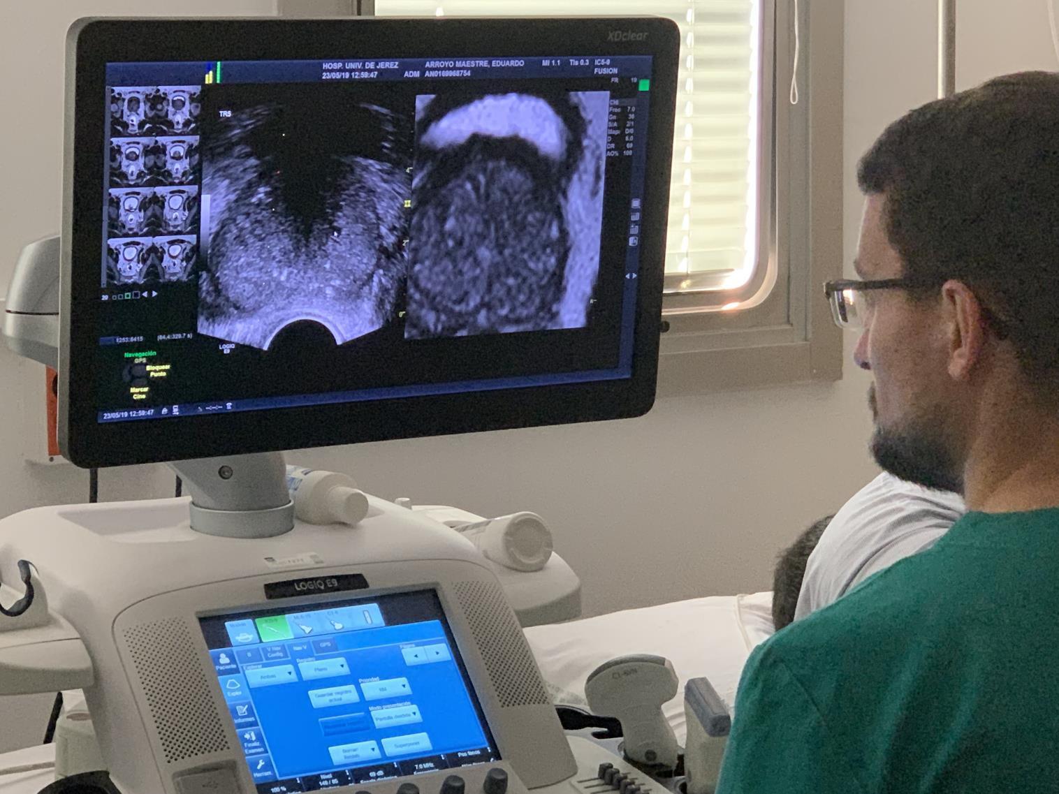 Imagen de un ecógrafo de urología en el Hospital de Jerez. FOTO: JUNTA DE ANDALUCÍA