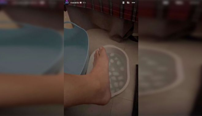 Imagen compartida por Kiko Rivera sobre el estado de su tobillo.