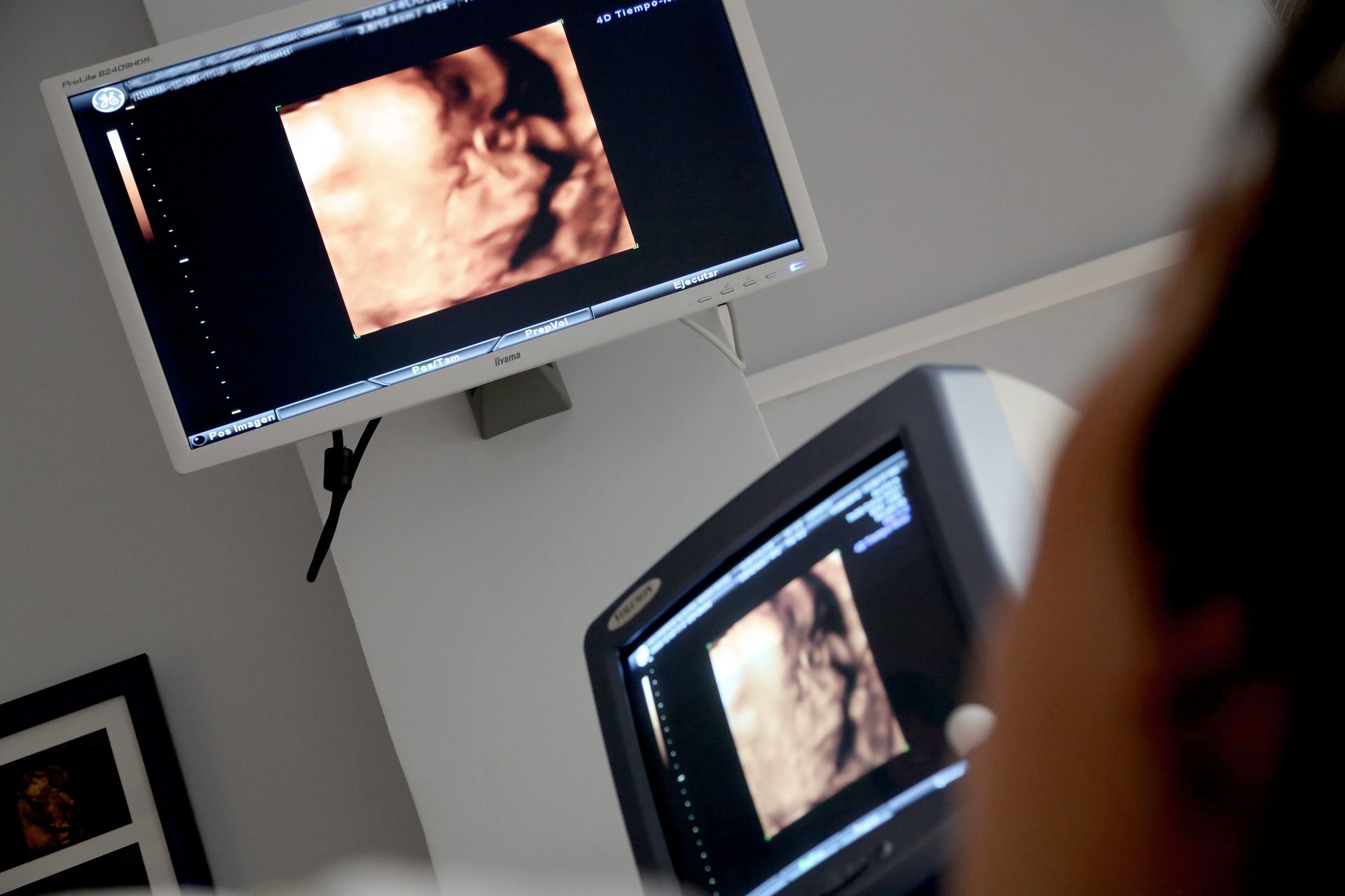Imagen de una ecografía en una imagen de archivo. Sólo un centro público en Andalucía realiza abortos.