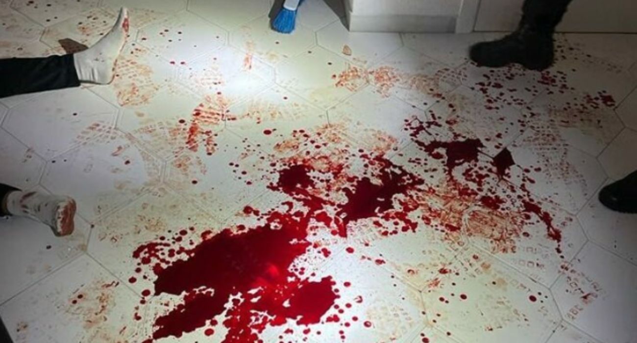 Los pies de uno de los heridos, junto a la sangre fruto del impacto. 