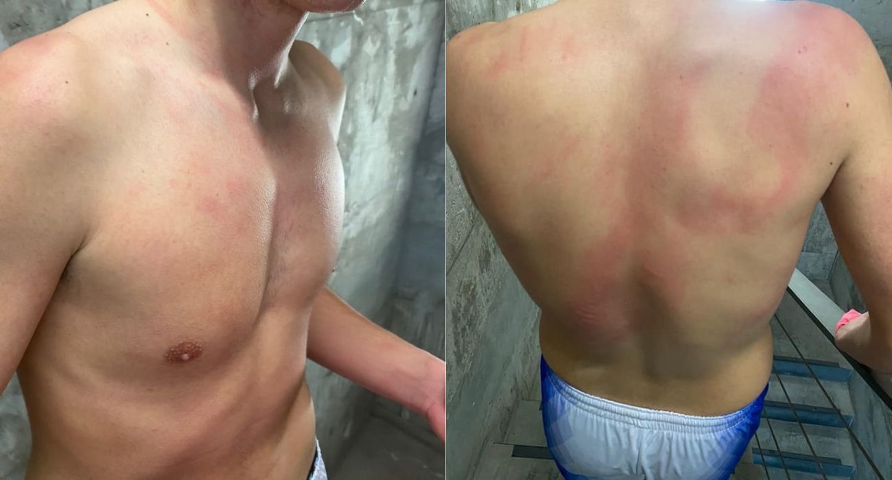 Las lesiones sufridas por uno de los jugadores agredido en el partido.