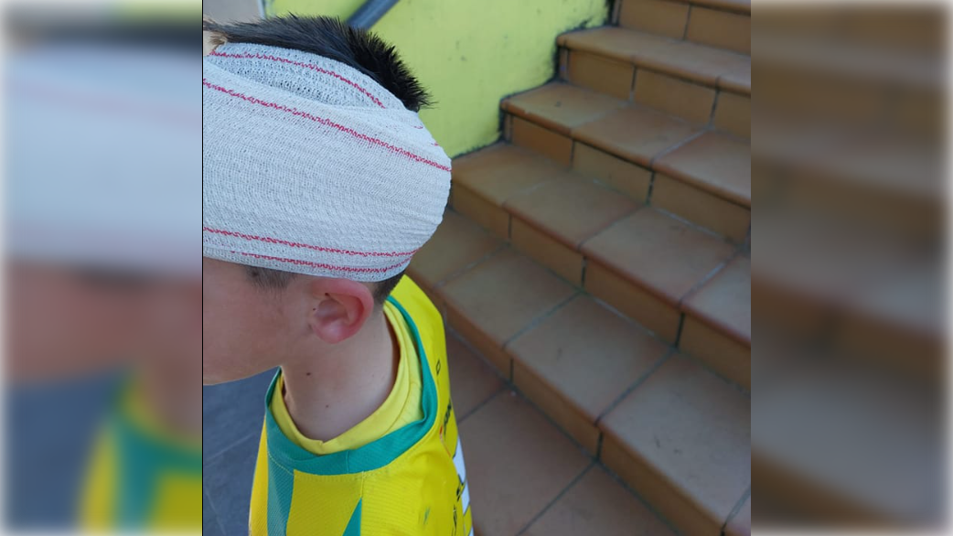 El menor que se llevó un fuerte golpe jugando al fútbol, con un vendaje en la cabeza.