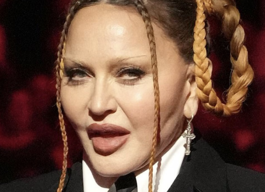 Madonna, tras los ataques por su nuevo rostro en los Grammy: "Inclínense perras".