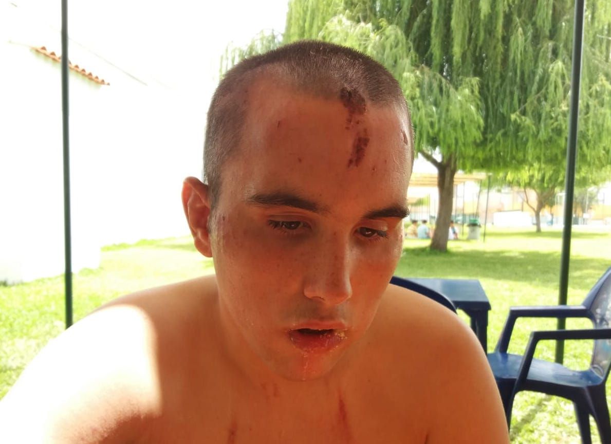 Rafael, con heridas, en una imagen reciente.