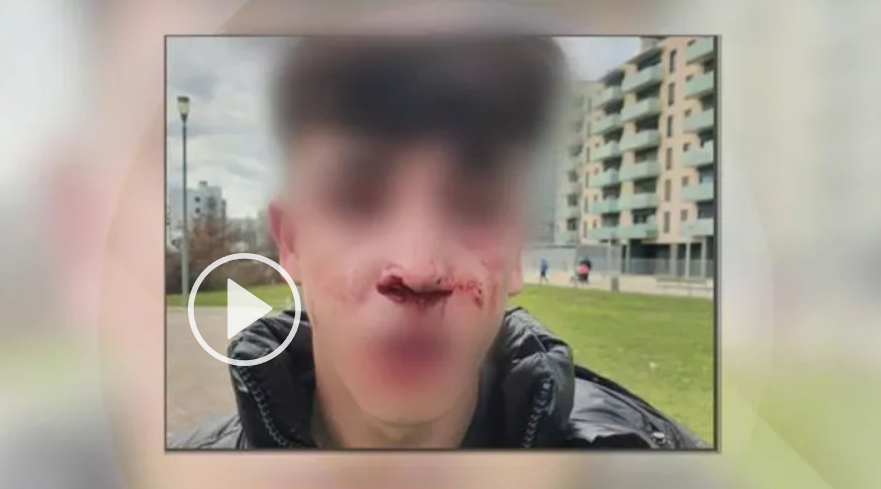 El menor agredido por unos agentes de Policía Local.