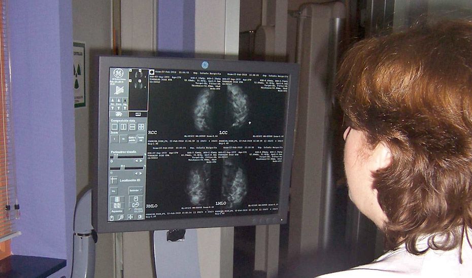 Una profesional examina una mamografía.