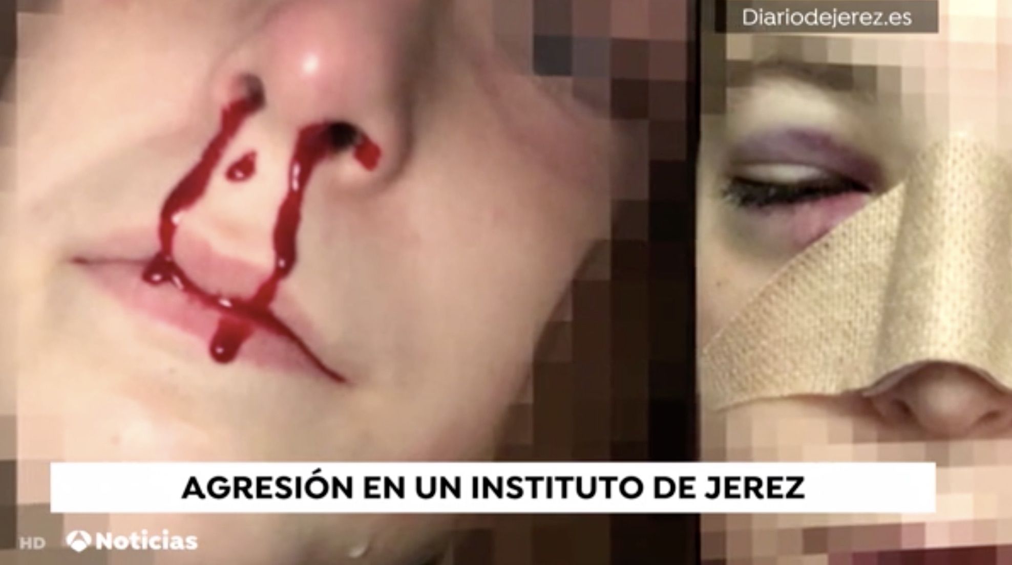 Imagen de la alumna agredida, en las noticias de 'Antena 3'.