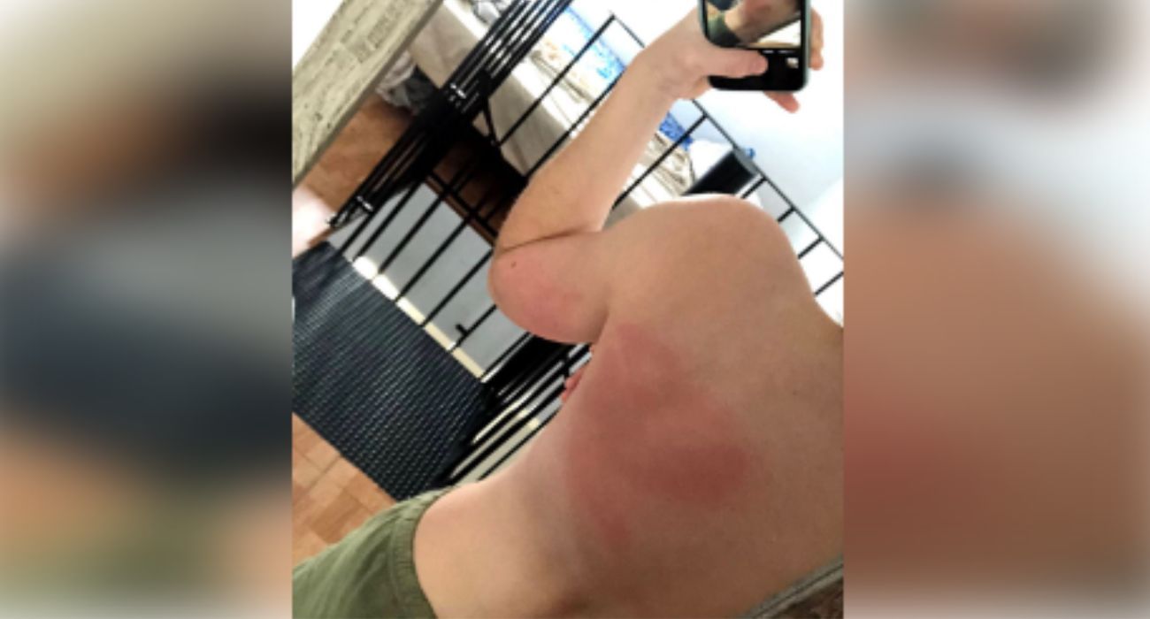 Una de las agresiones sufridas por la joven.