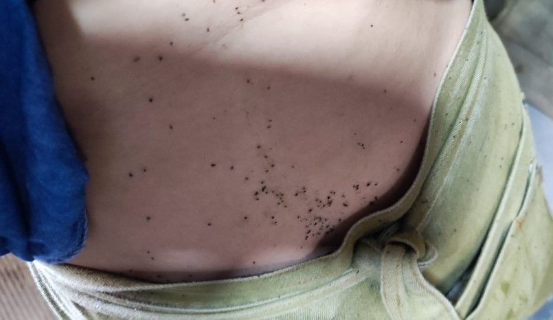 Mosquitos pegados a la piel tras meterse por la ropa. CEDIDA