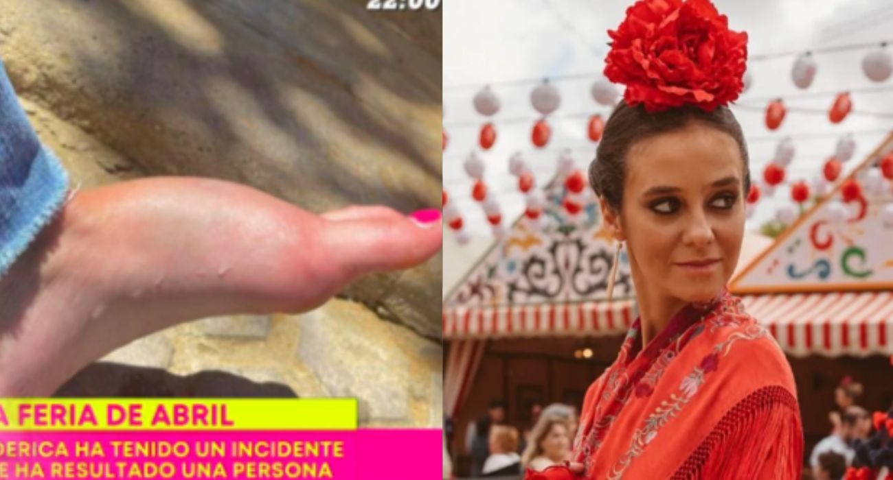 Así ha dejado la nieta del rey emérito el pie a la joven que ha atropellado.