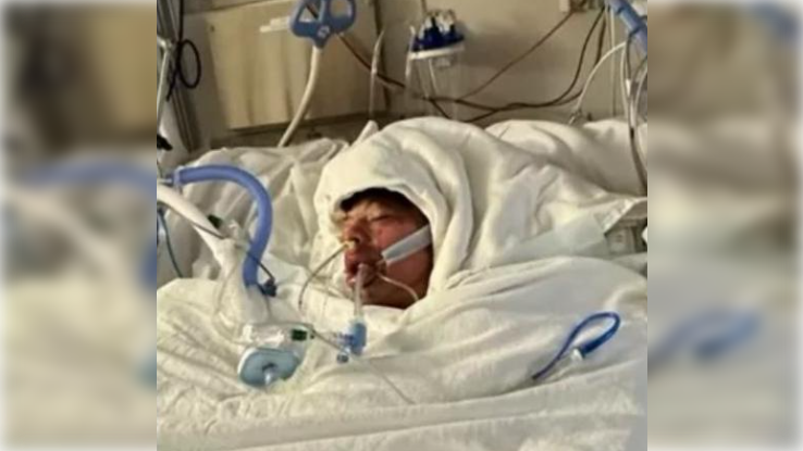 El menor de EEUU que se ha quemado por un reto de TIKTOK. GOFOUNDME 