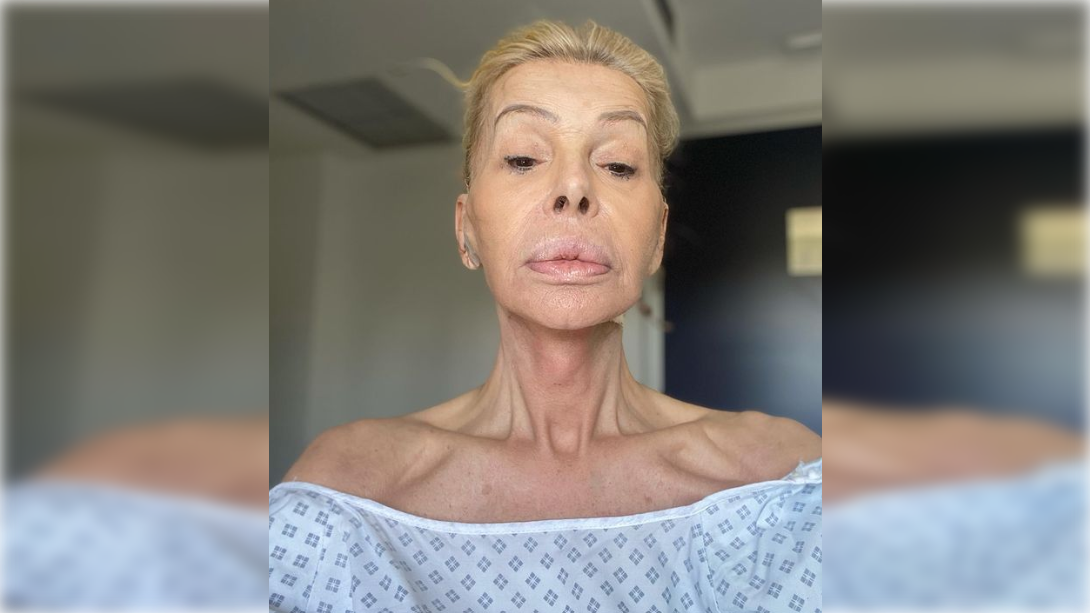 La actriz Bibiana Fernández, ingresada en el hospital tras pasar por el quirófano. INSTAGRAM