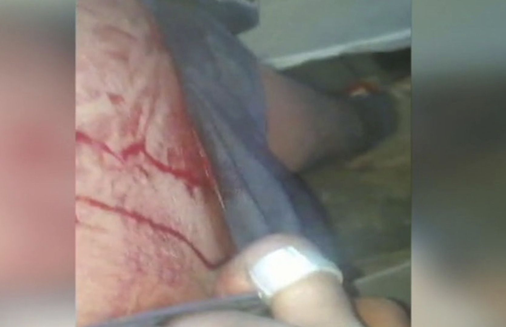 Imagen del agredido mientras es trasladado al hospital.