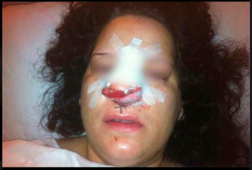 La mujer golpeada durante una detención.