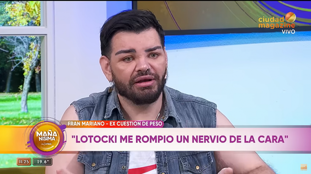 Un fan de Ricky Martin, con parálisis facial tras 27 operaciones para parecerse a él. YOUTUBE