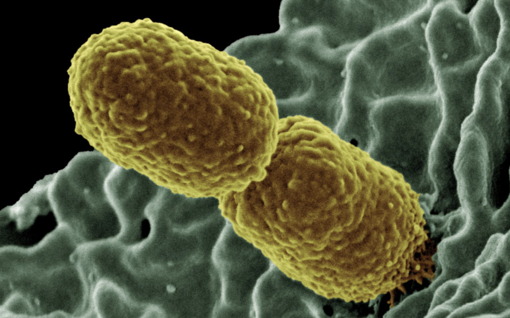 El brote de la 'superbacteria' klebsiella en Málaga pone en alerta al SAS.