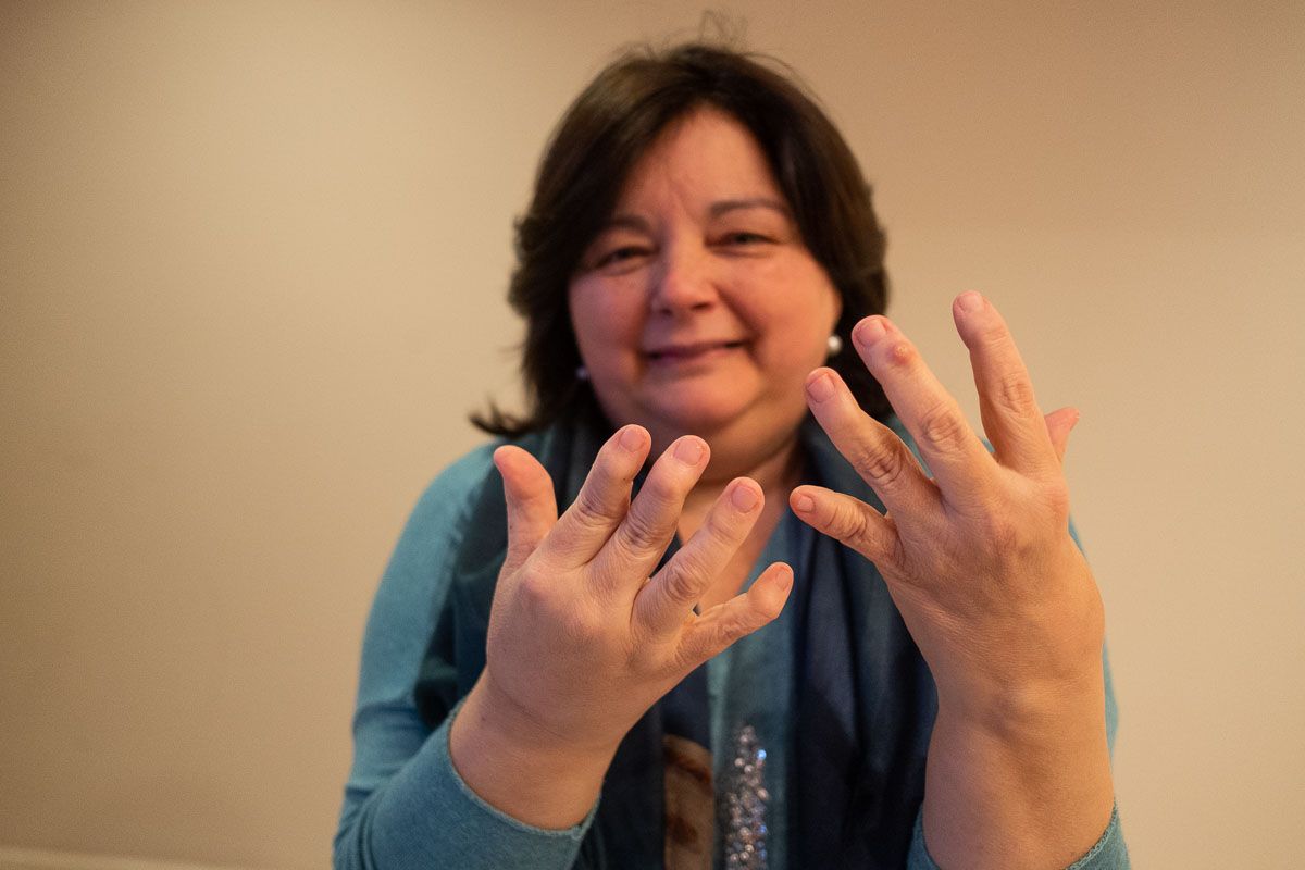 María Rosa Mariscal, presidenta de Ajerea, muestra sus manos afectadas por la enfermedad. FOTO: MANU GARCÍA