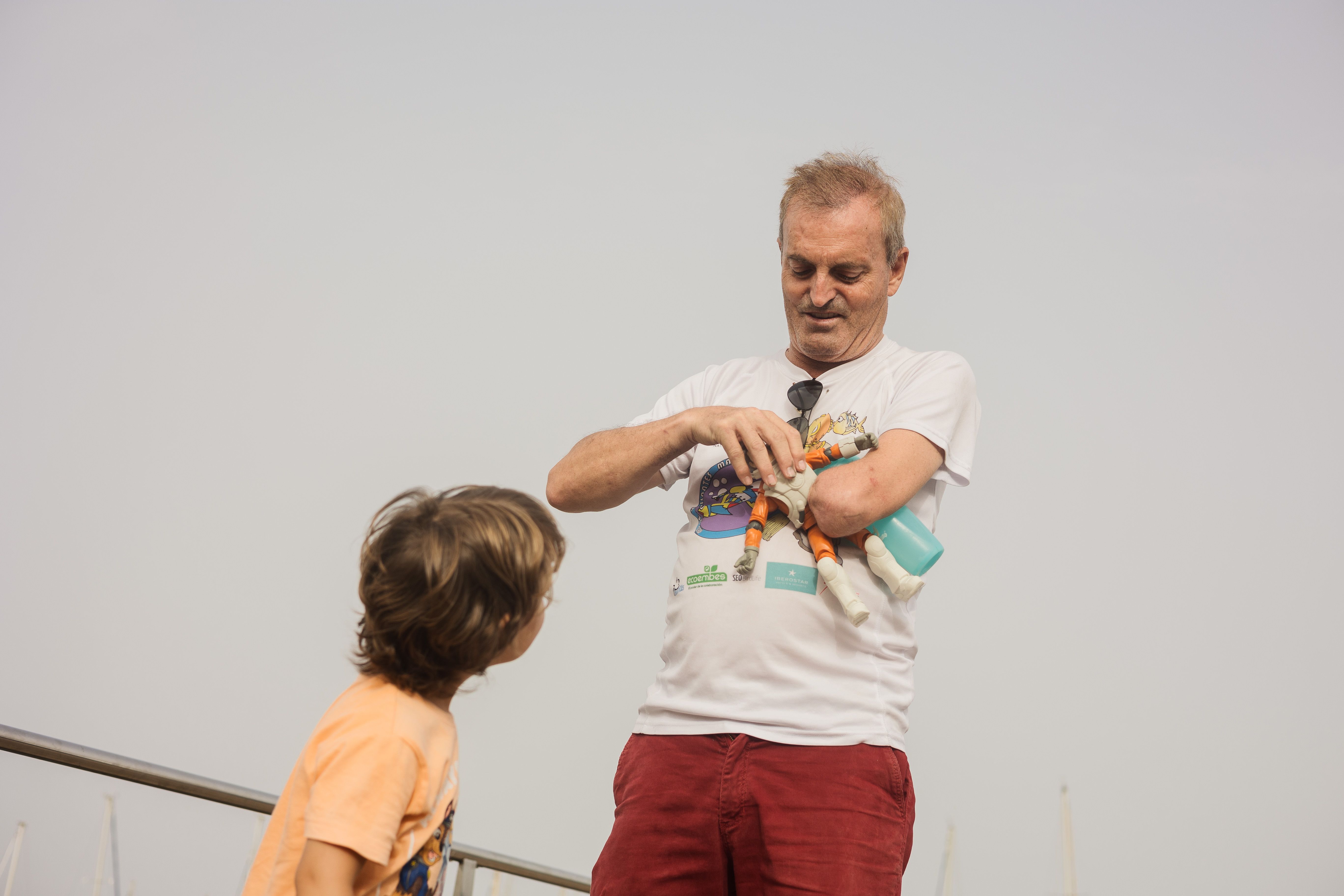 Su hijo observa el muñón.