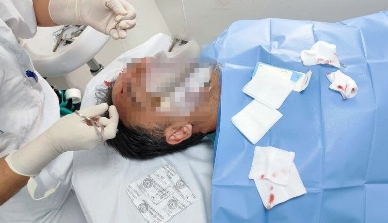 Uno de los agentes de la Guardia Civil agredidos. Uno de los agentes de la Guardia Civil agredidos.