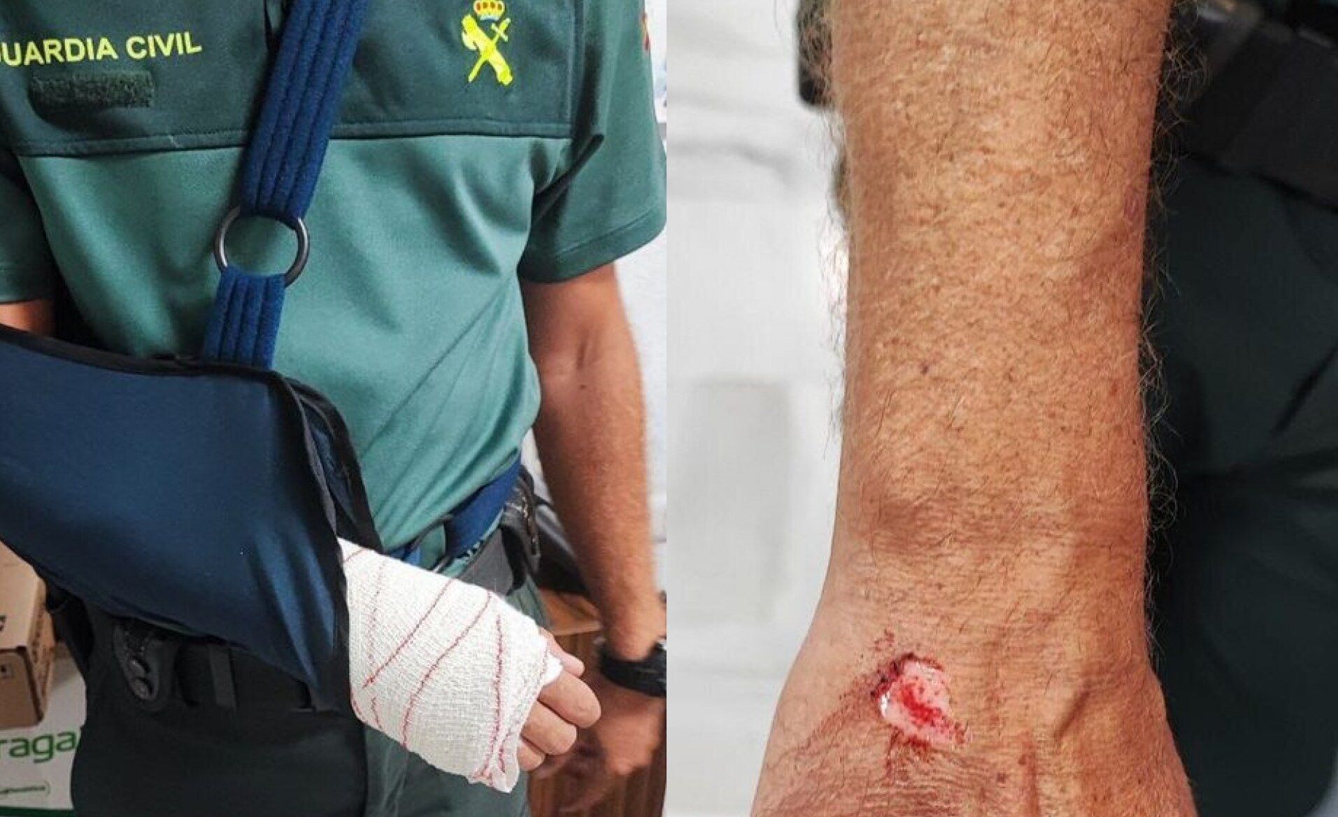 Estado en el que quedaron dos agentes de la Guardia Civil tras la agresión de Chiclana. Estado en el que quedaron dos agentes de la Guardia Civil tras la agresión de Chiclana.