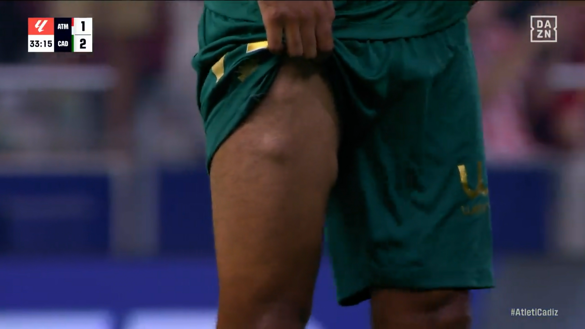 La brutal imagen de la pierna de Fali.