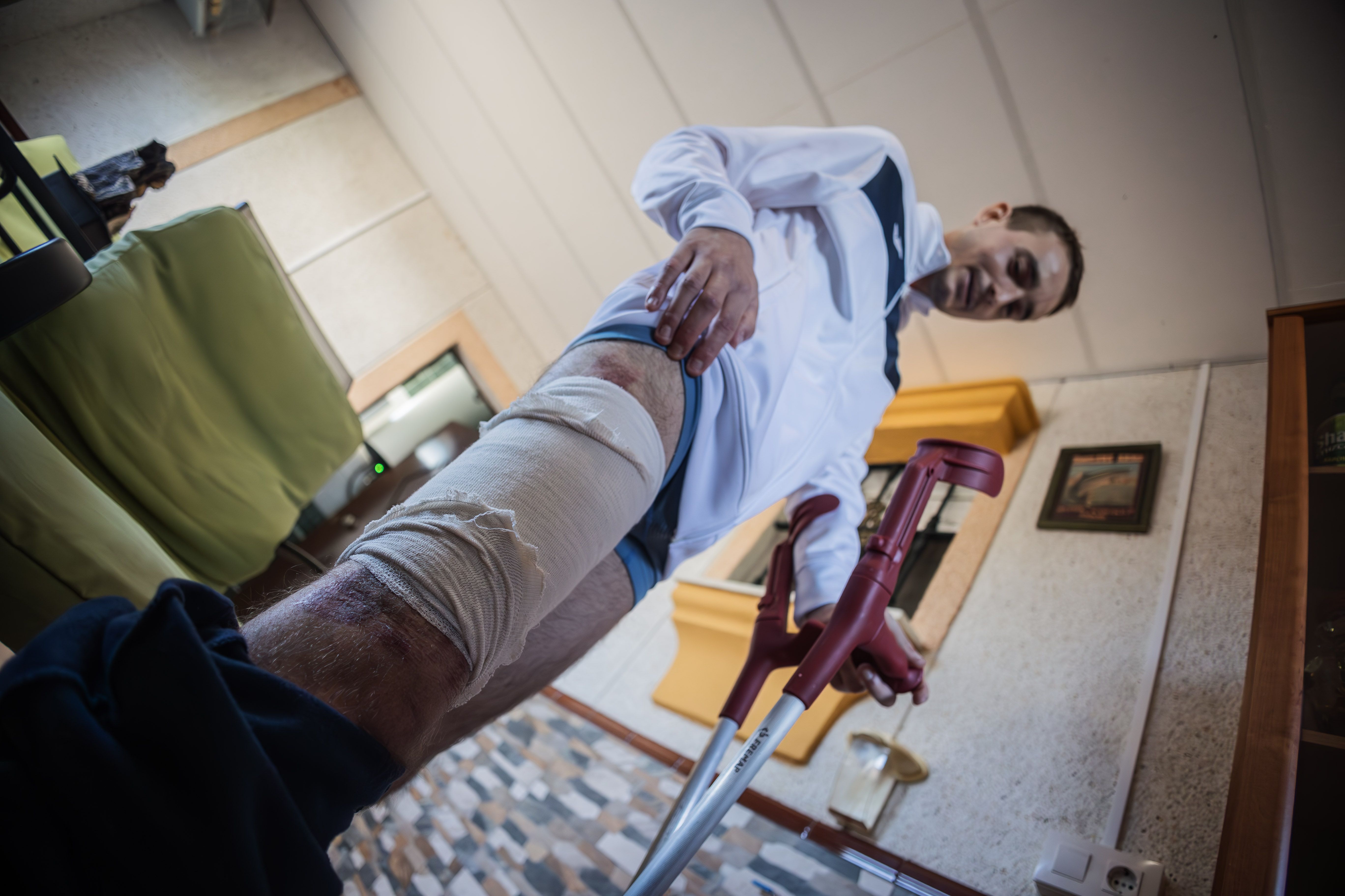 José Manuel Pérez Oviedo, enseñando las heridas en la pierna tras ser atropellado por un menor.