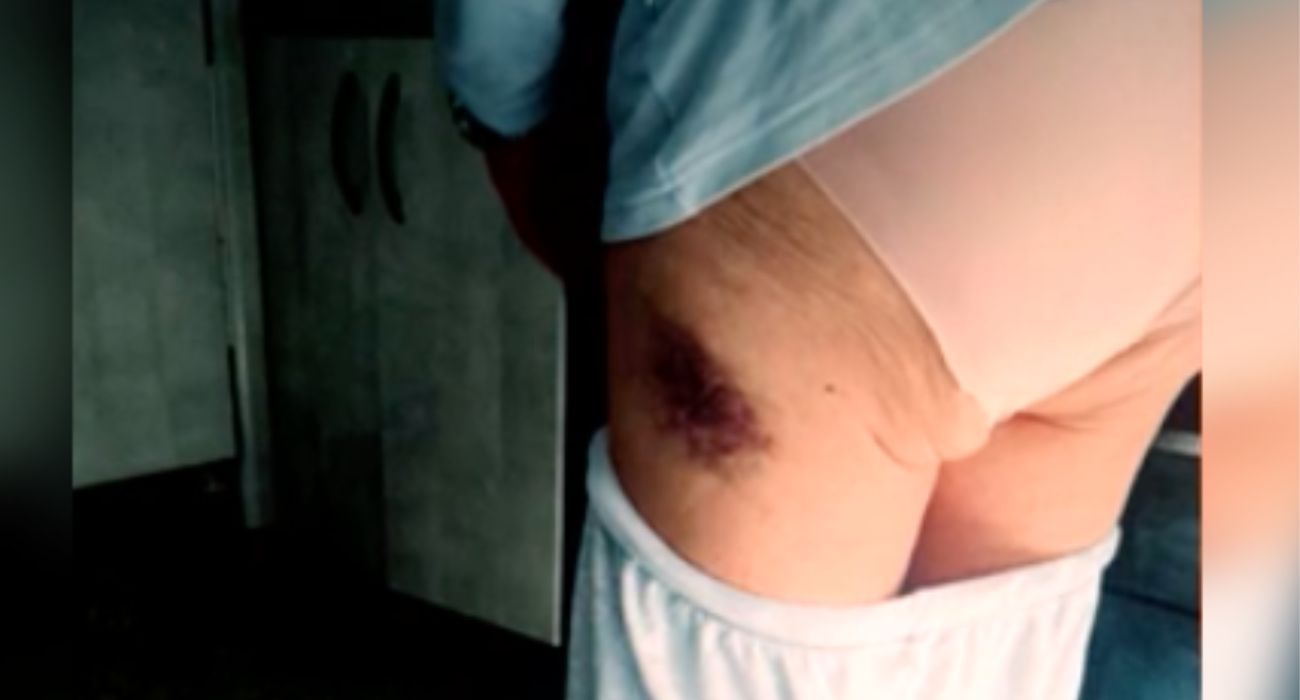 Un féretro en la puerta de su trabajo, amenazas y moratones como el mostrado por el programa 'Y ahora Sonsoles'.