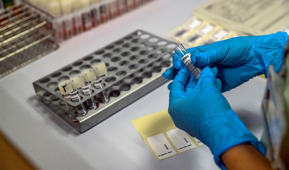 Pruebas de Covid-19, en una imagen de la Junta.