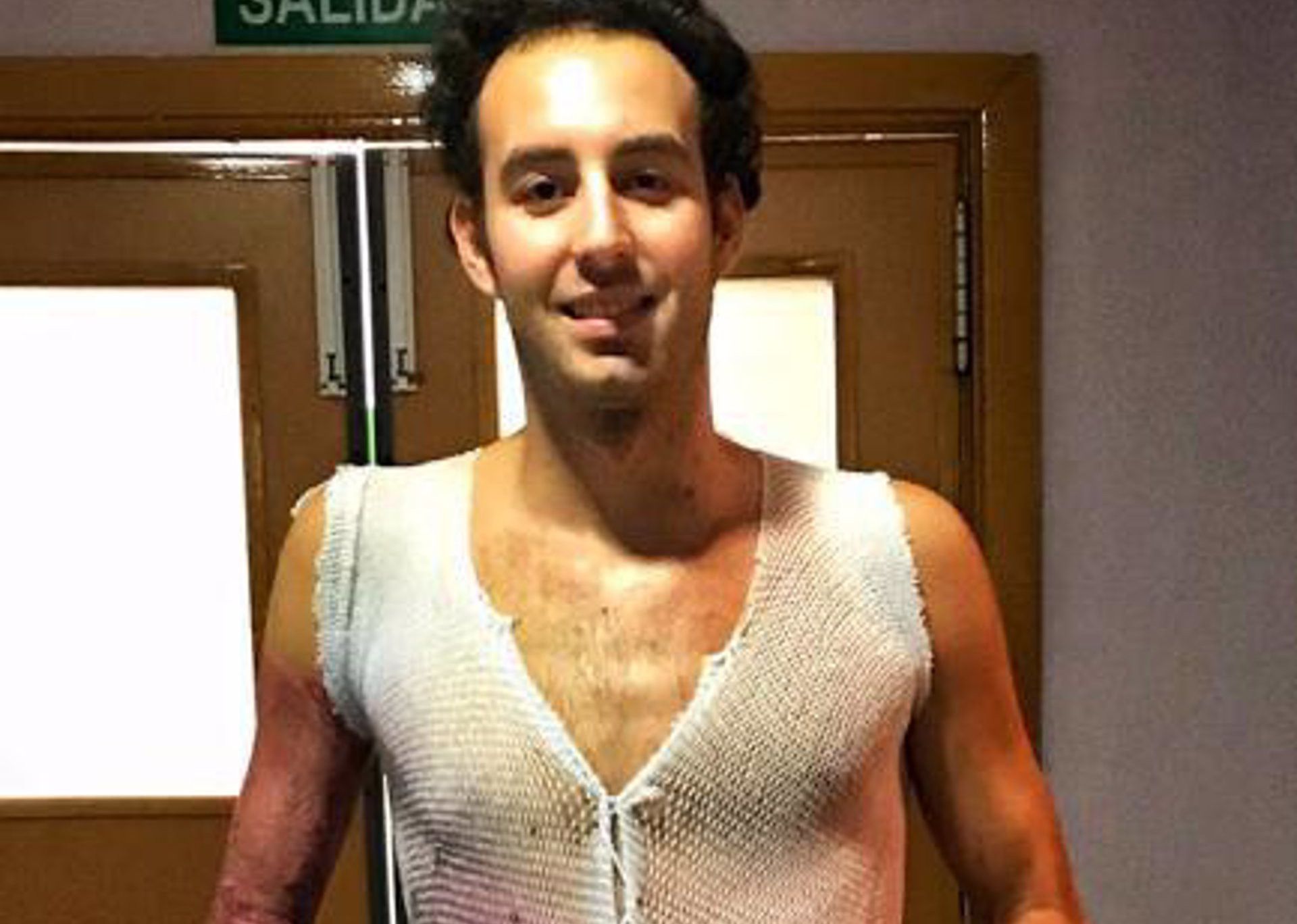 Álvaro Trigo tiene la piel artificial implantada. 