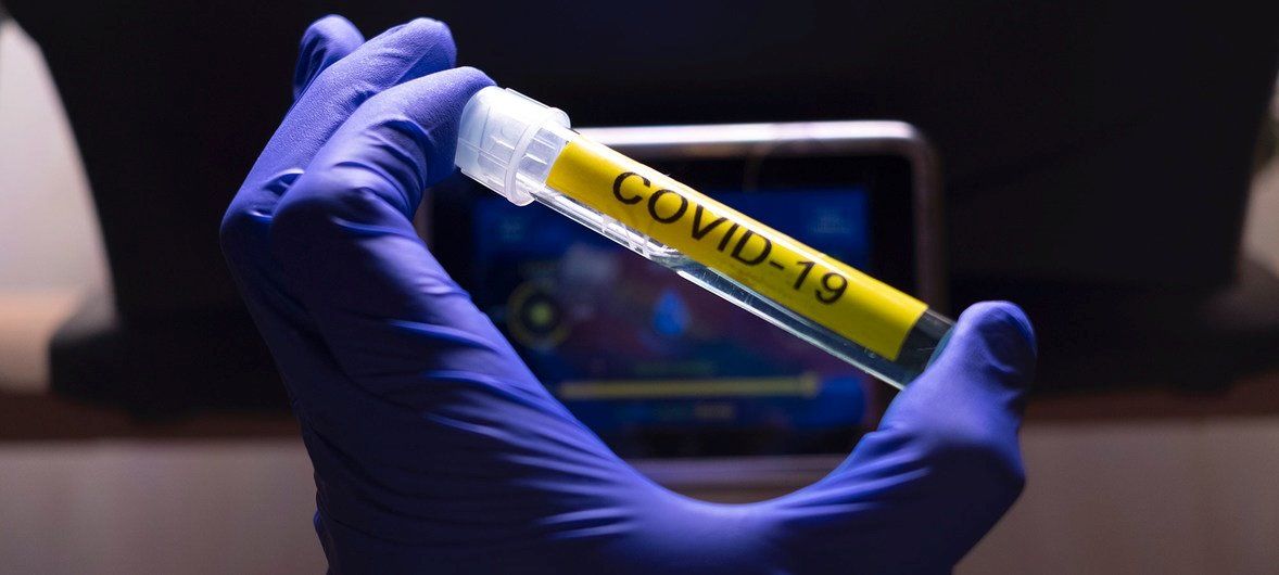 Una muestra de test de coronavirus - ONU-LOEY FELIPE