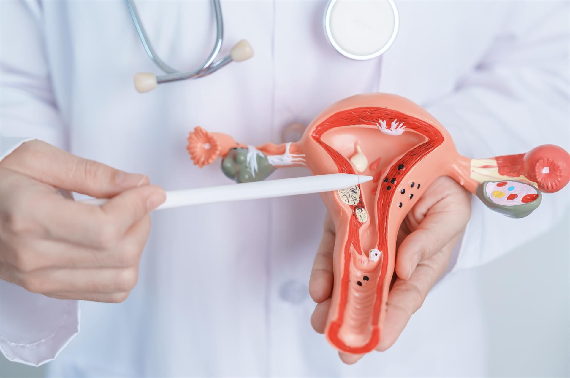 Andalucía inicia en verano el plan de cribado para prevenir cáncer de cuello de útero desde los 25 años.