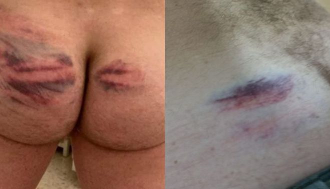 Dos de los aficionados agredidos.