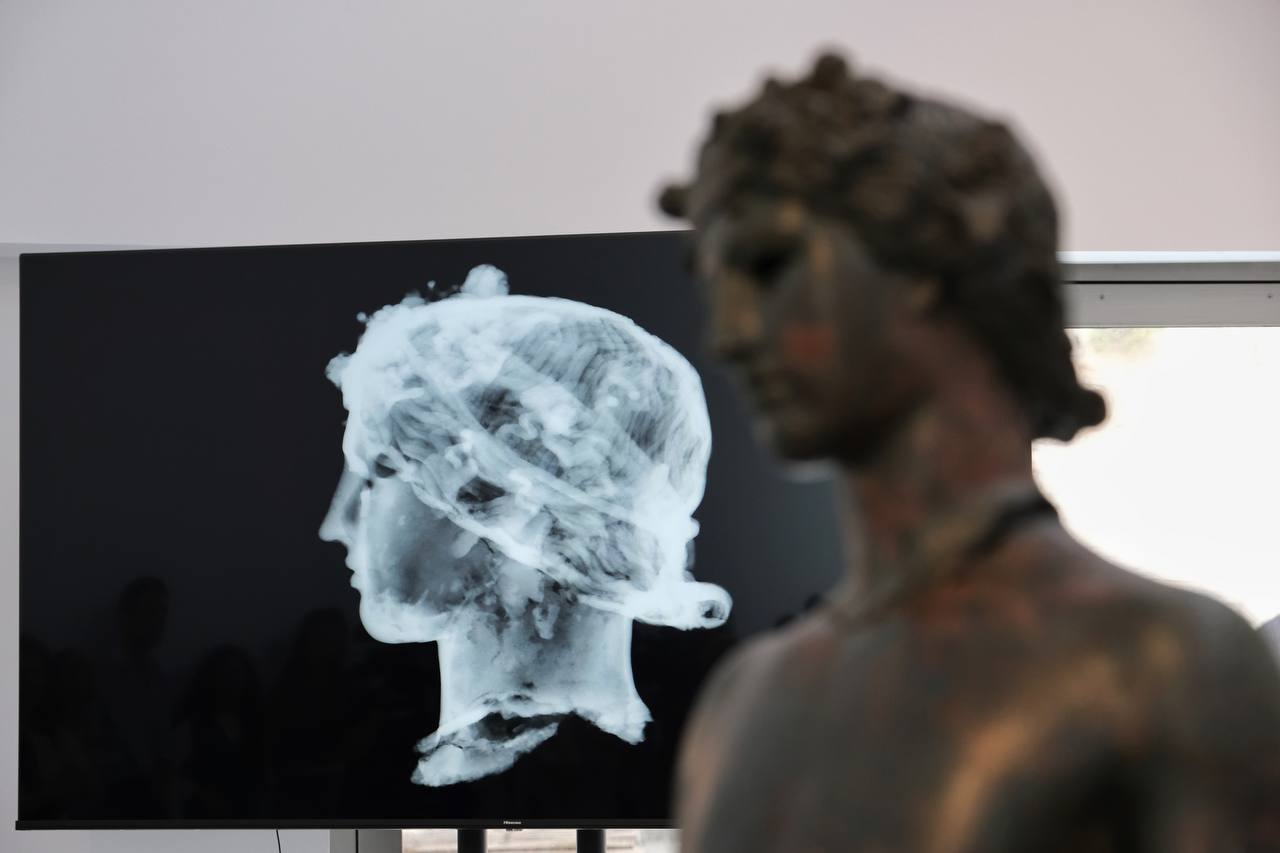 Uno de los efebos de Pedro Abad, que han sido restaurados empleando técnicas innovadoras como las de examen por imagen. Uno de los efebos de Pedro Abad, que han sido restaurados empleando técnicas innovadoras como las de examen por imagen.