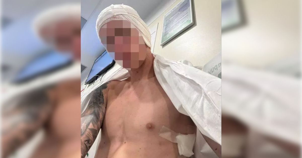 El joven agredido por un paquete de tabaco.