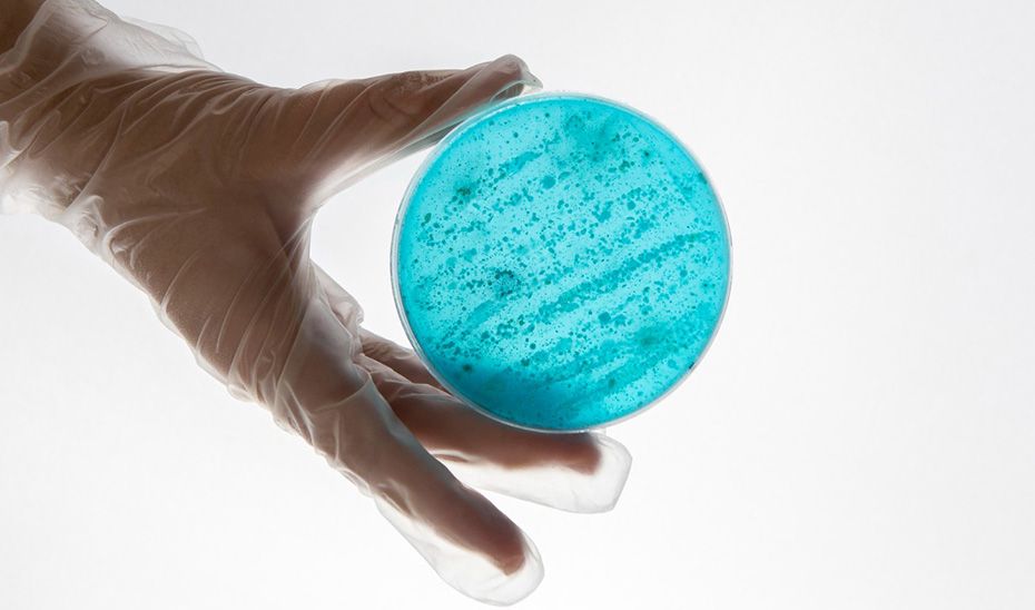 Andalucía intensifica las medidas frente al sarampión tras la detección de 47 casos. En la imagen, una muestra de microbiología.