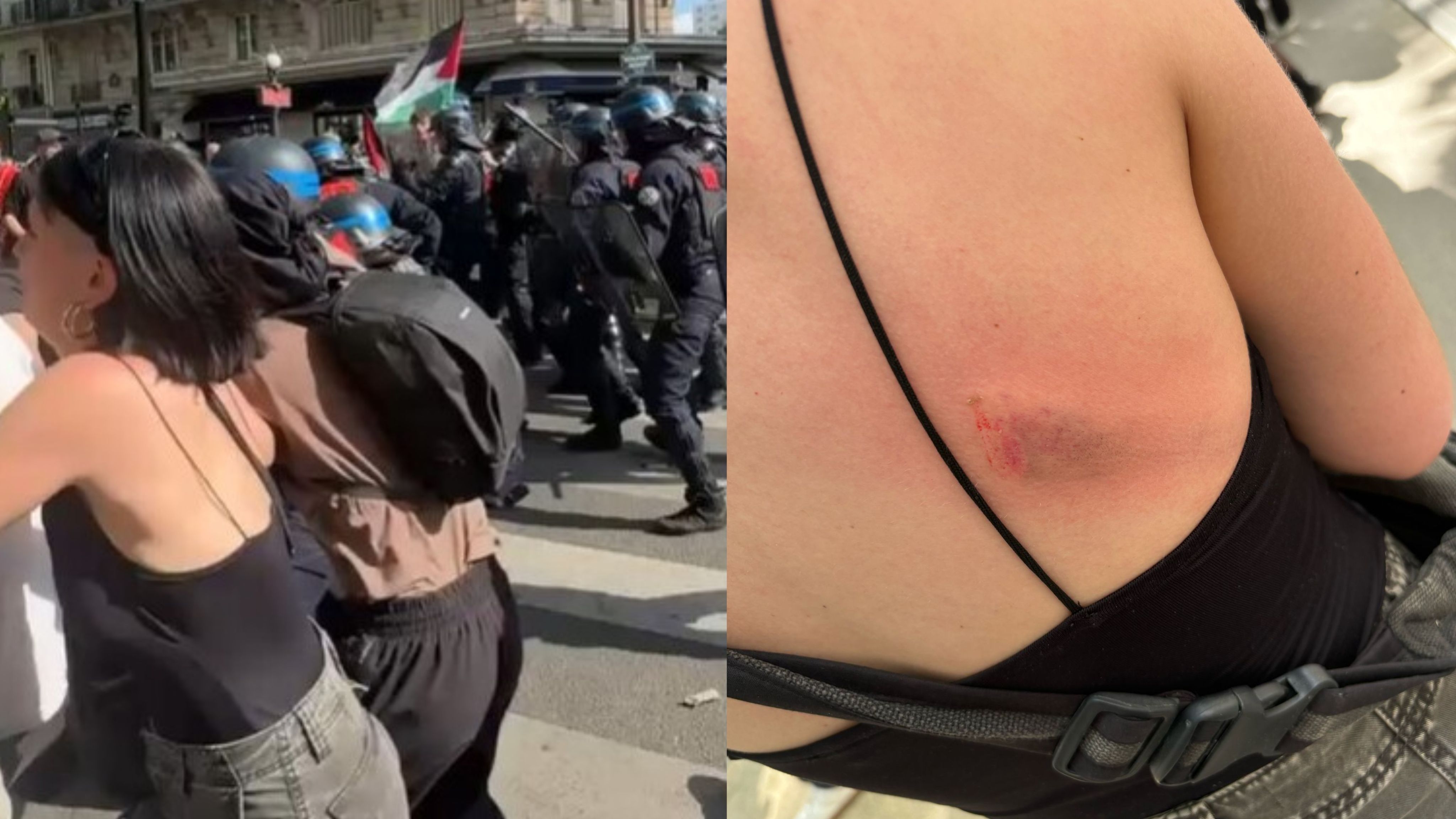 Andrea, antes de la agresión y uno de los moratones que le causaron.